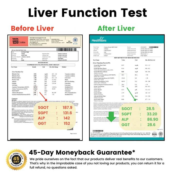 Liver Detox | Made 7+ Natural Herbs for All Liver Problems